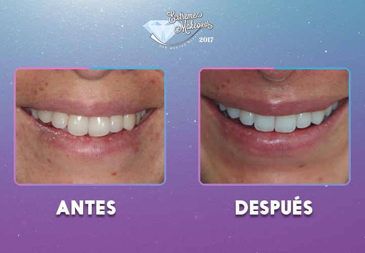 dientes1-(1)