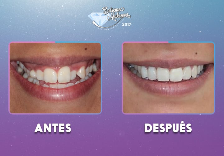 dientes1