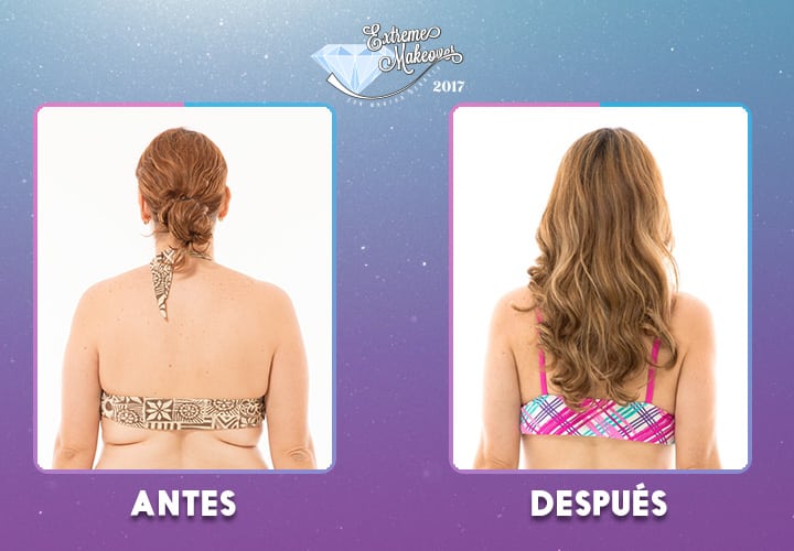 pelo-(1)