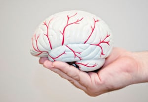 Infartos-cerebrales