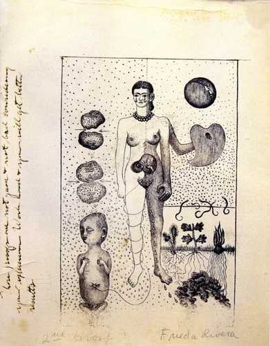 Imagen 7- El aborto 1932