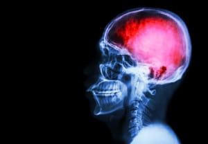X-ray asian skull and blank area at left side