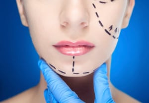 Lifting-facial