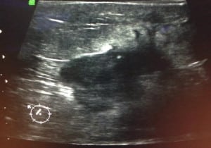 unnamed3