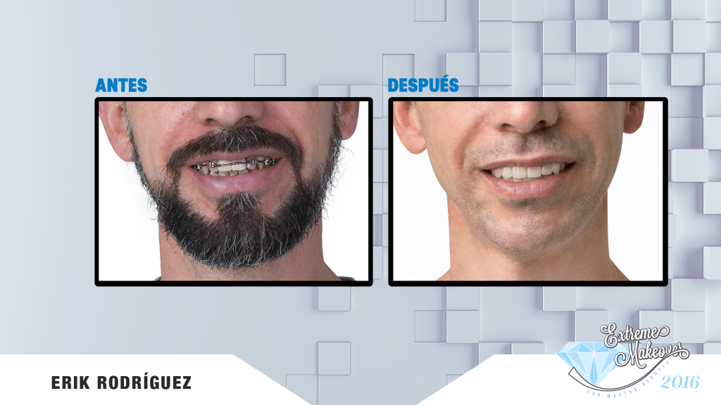 barba-el
