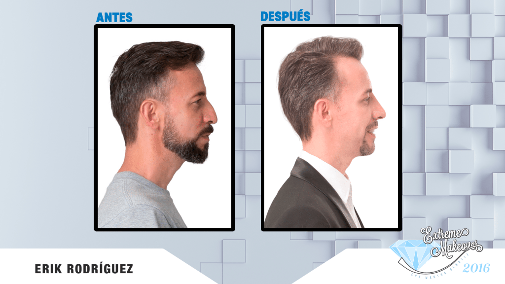 nariz-el