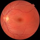 ojo1