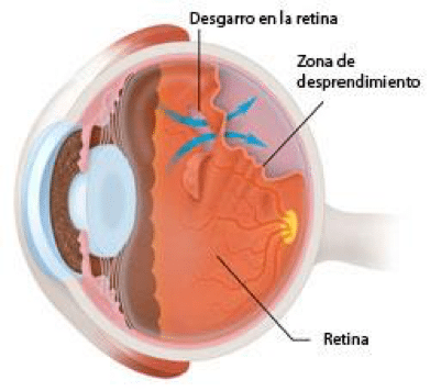 ojo10