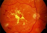 ojo11