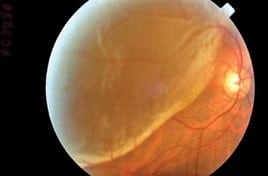 ojo7