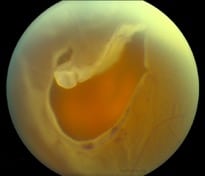 ojo8