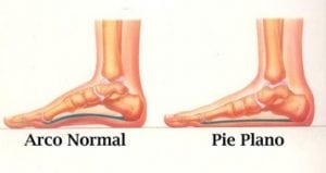pie1
