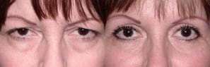 ojos3