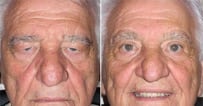 ojos4