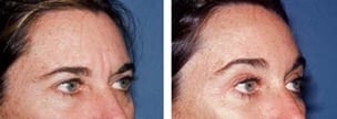 ojos6